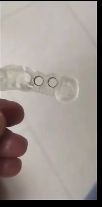 Resin Dental 3D Printer Planti - 3D Printing Uv Resin review and price