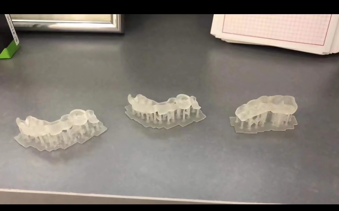 Resin Dental 3D Printer Planti - 3D Printing Uv Resin review and price